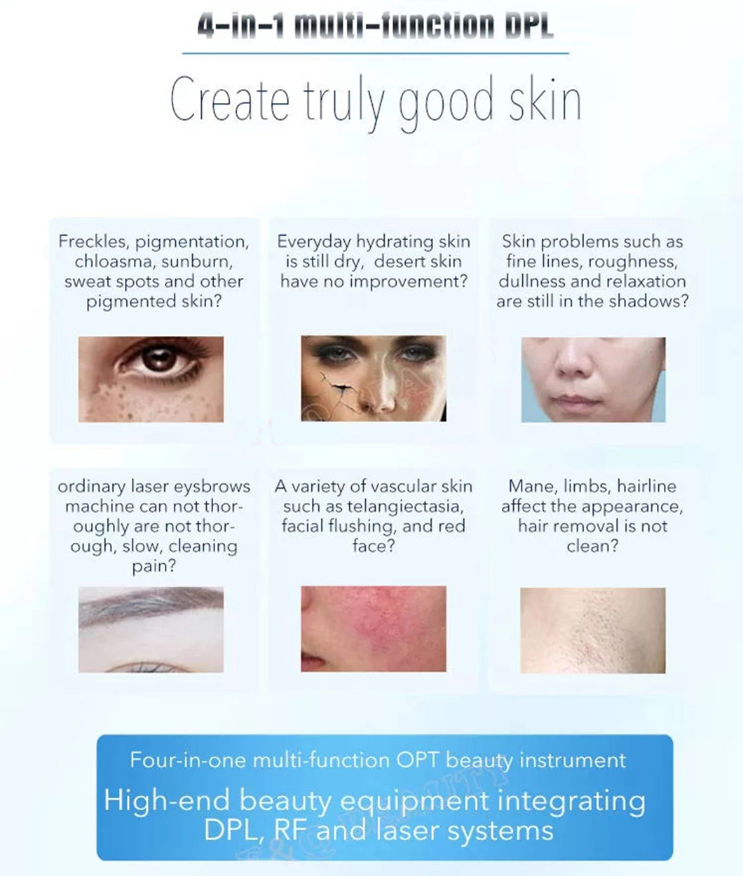 Laser Hair Removal 808nm Tce Removal Skin Rejuvenation Face Lifting Carbon Peeling Skin Whitening Machine