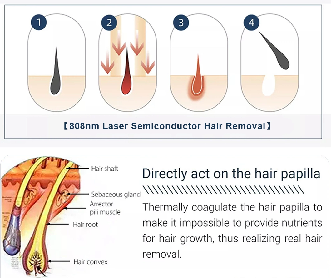 Picosecond Laser Tattoo Removal Machine No Skin Damage Tattoo Remove Spots Picosecond Laser Upgrade System Portable