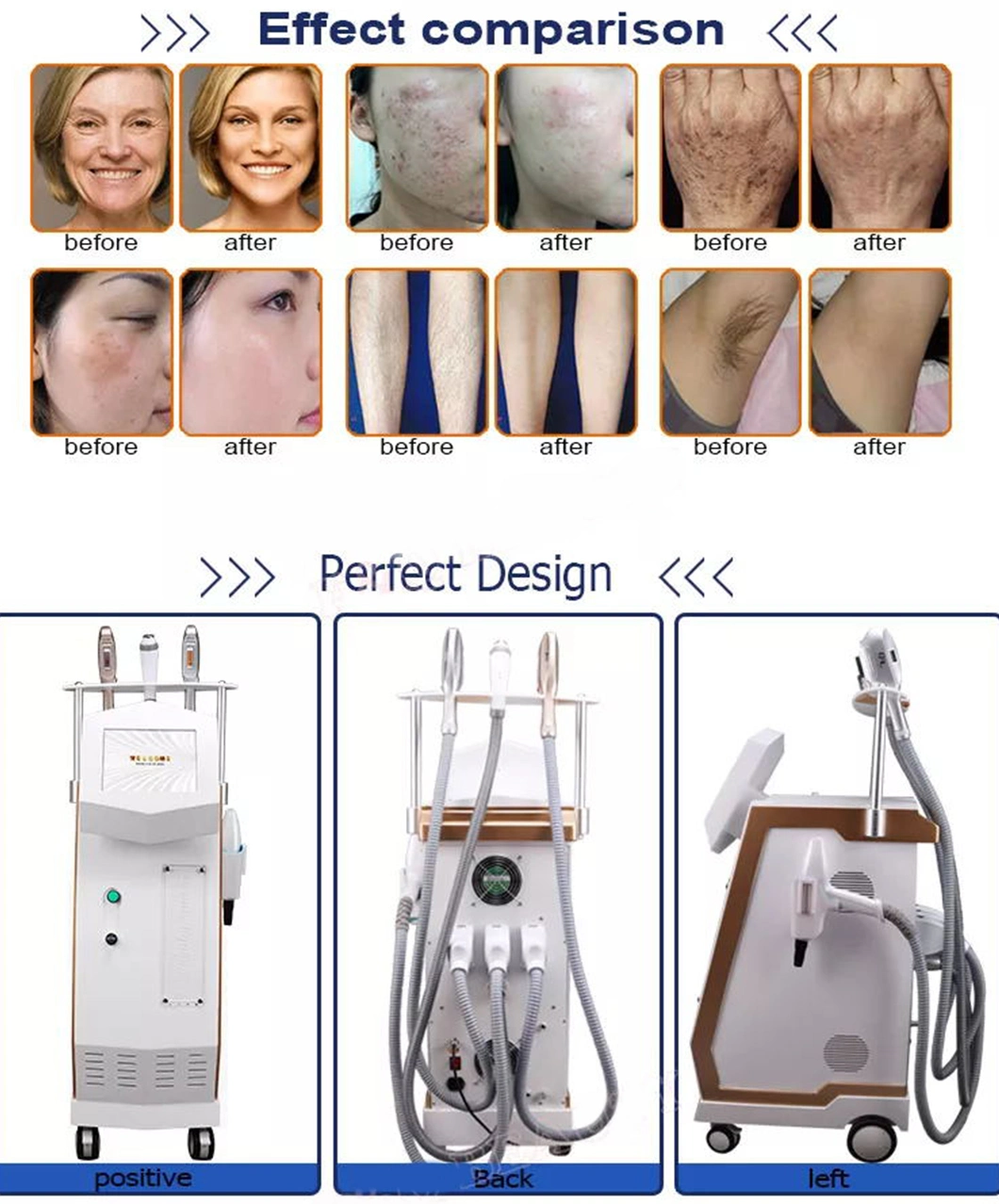 Laser Hair Removal 808nm Tce Removal Skin Rejuvenation Face Lifting Carbon Peeling Skin Whitening Machine