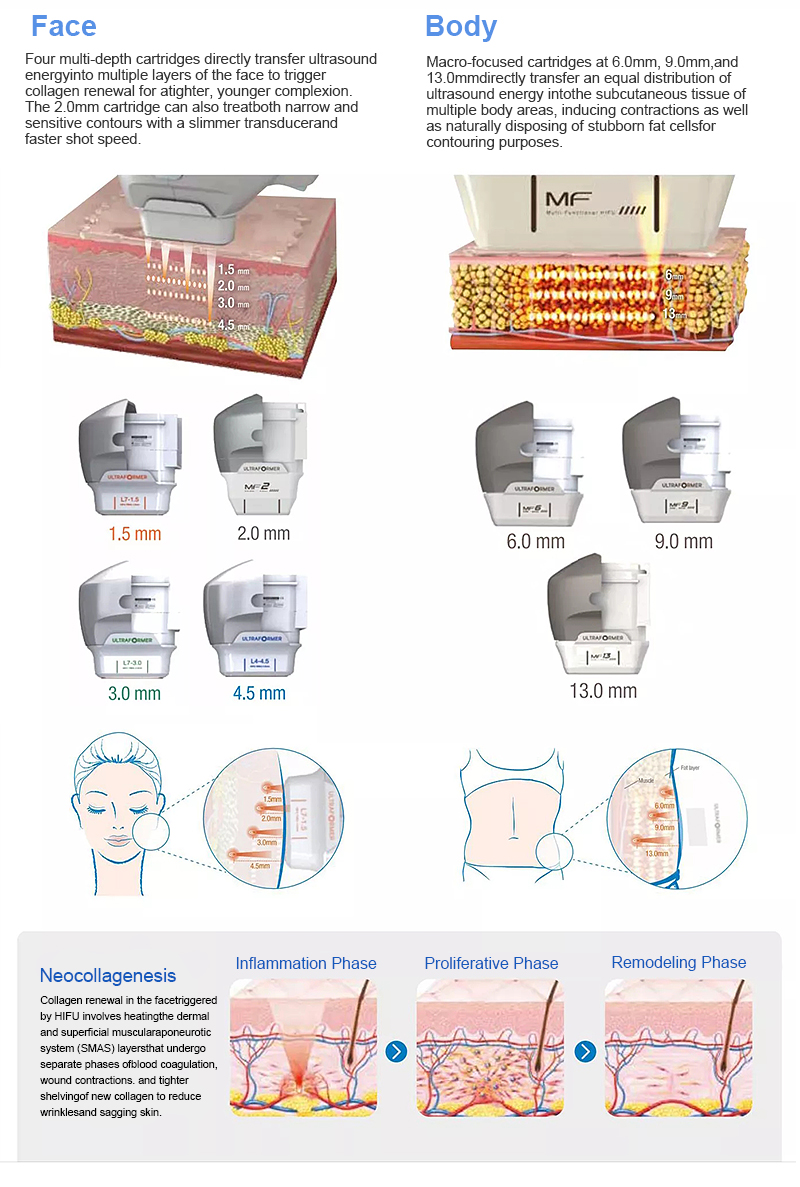 medical hifu machine