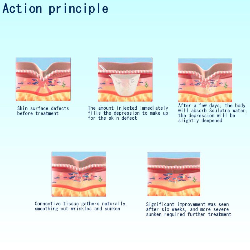 View File