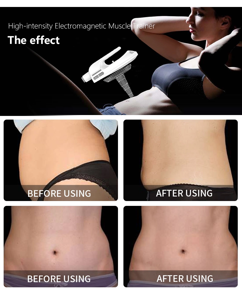 Medical Approved High Intensity Pulsed Electromagnetic Fat Reduce Muscle Build EMS Body Sculpting Muscle Stimulator