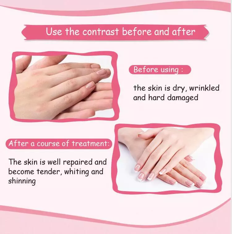 Private Label wholesale exfoliating Whitening  hand mask Collagen whitening hand peel mask pack