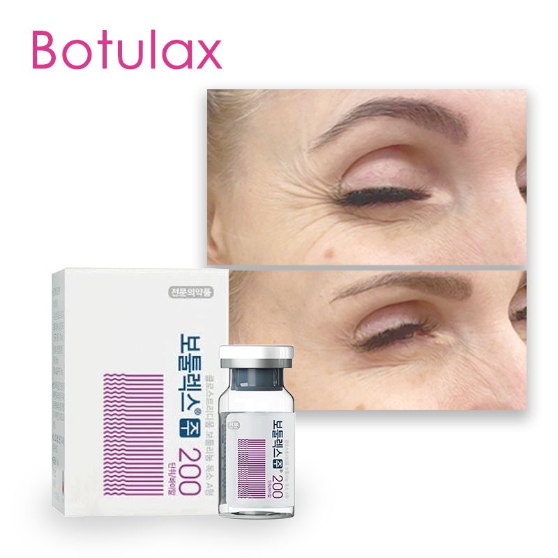 High Quality Anti Wrinkle Removal 200iu Botulax Toxin Injection