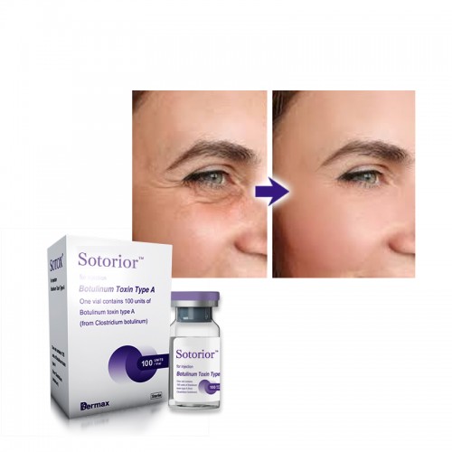 Sotorior High Purity Botulinum Toxin 100u Made by Vacuum Drying Technology
