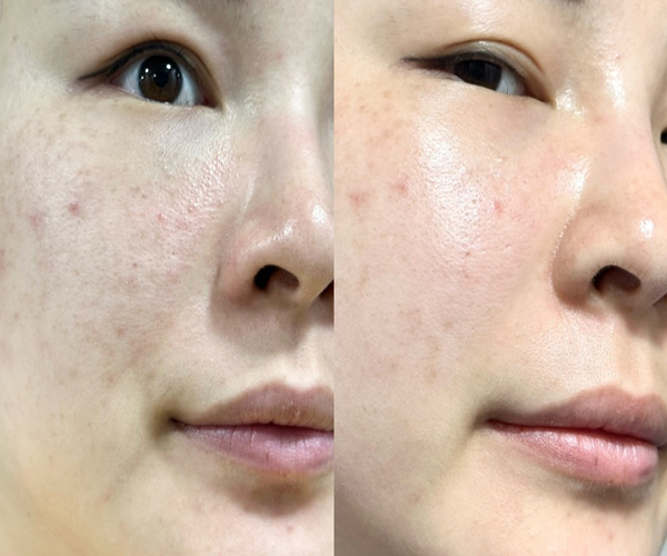 Skin Haya (functional mask pack, repeated use, whitening, elasticity, helps with skin troubles)