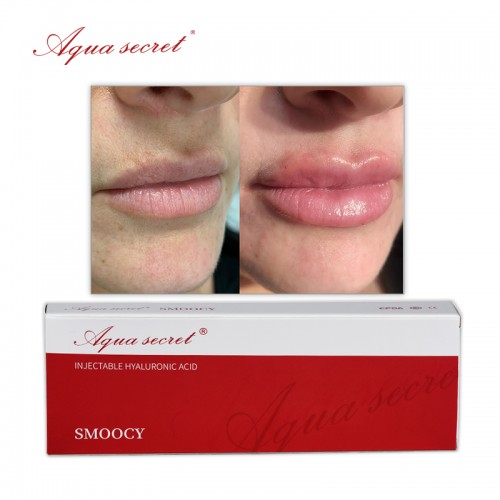 Aqua Secret best price 1ml dermal filler injection hyaluronic acid lip filler 2ml