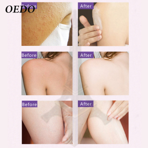 OEDO Lavender Body Lotion Moisturizing Anti-aging Body Creams Repair Anti-chapping whitening Nourishing Skin Care