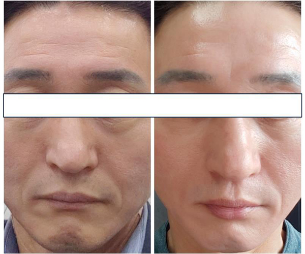 Skin Haya (functional mask pack, repeated use, whitening, elasticity, helps with skin troubles)