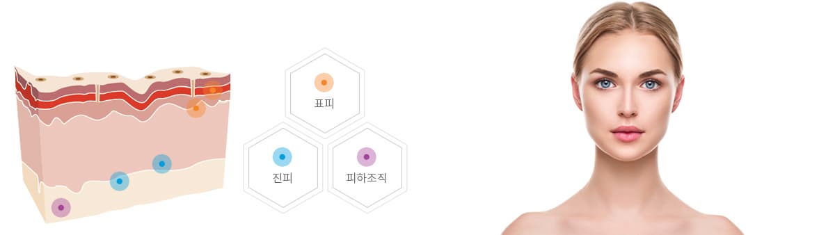 Dermalax Plus
