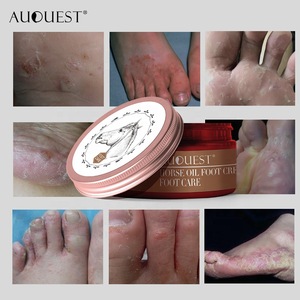 https://www.beautetrade.com/uploads/images/products/0/2/foot-defrosting-remove-dead-skin-foot-cream-for-peeling-cuticles-heel-skin-care5-0655531001557228436.jpg