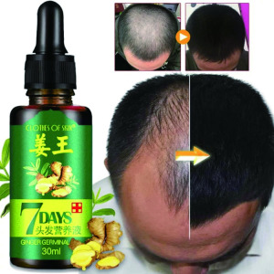 Hair Loss Treatment Anti Balding Natural Remedies 30ML Ginger Germinal Oil Hair Growth Oil