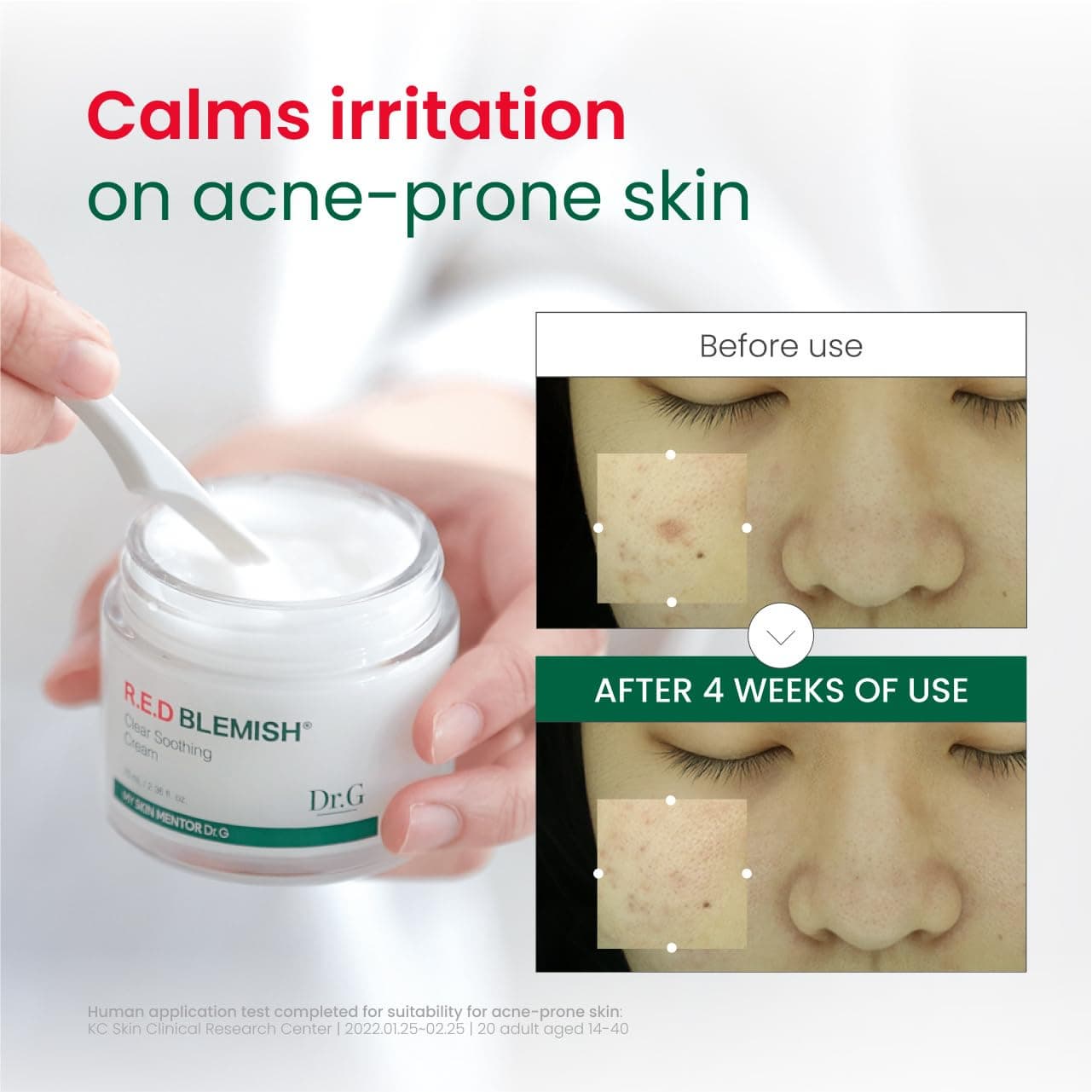 Dr. G R.E.D. Blemish Clear Soothing Cream