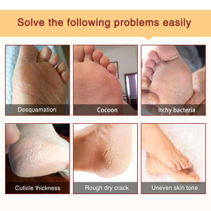Hot sale best foot skin care peeling foot mask Remove Dead Skin Exfoliating Foot Mask Socks