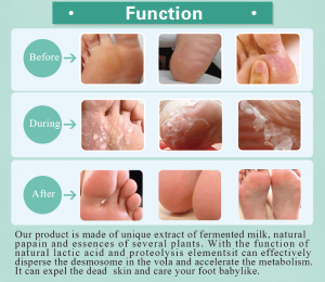 OEM professional foot beauty care products remove the dead skin of the feet foot mask