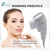 High Intensity Focused Ultrasound Hifu Facial Lifting Anti-Wrinkle Machine Ultra Hifu 7D Hifu Portable