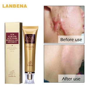 2018 hot sale LanBeNa Skin Care Dark Spot Repairing Gel Acne Scar Removal Cream 30ml