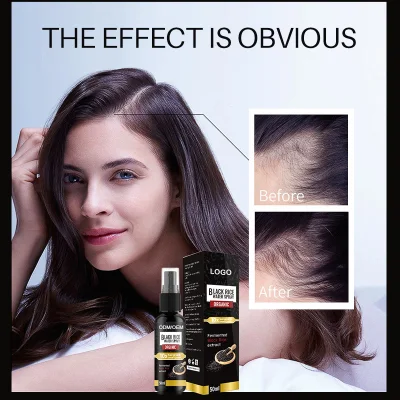 Beauty Cosmetics Skin Care Hair Growth Serum Black Rice Water Spray