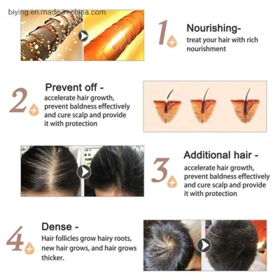Private Label Hair Care Regrowth Hair Loss Treatment Bald Hair Regrowth Effective Hair Growth Spray