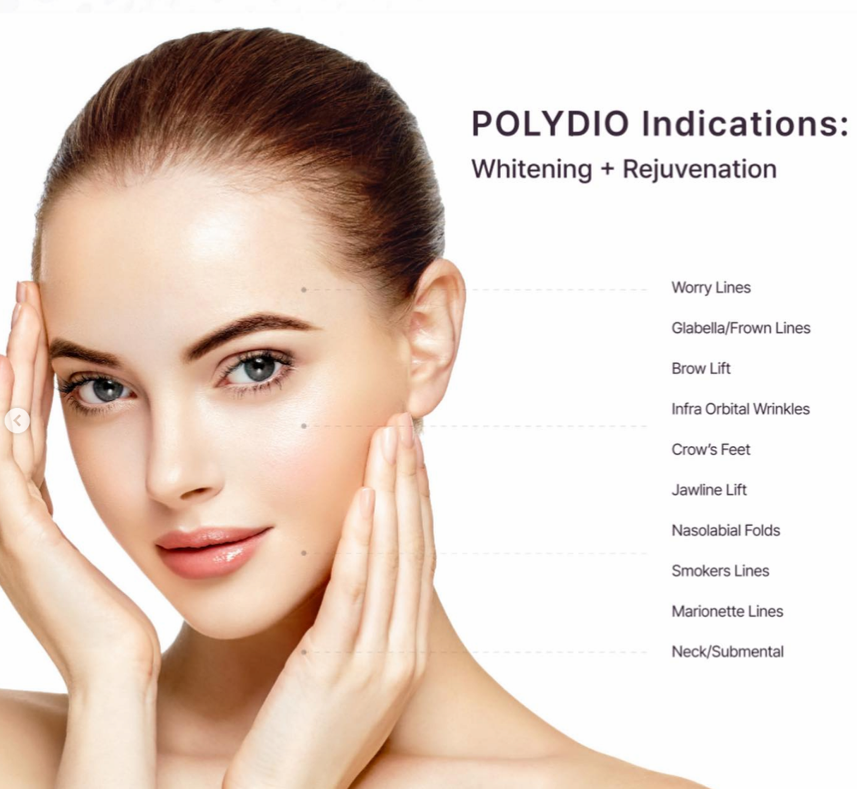 POLYDIO  PDO Dermal Filler,Whitening, Rejuvenationan