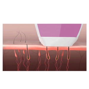 Electric Hair Epilator & Skin Rejuvenation Home Use Laser Hair Removal Portable Hair Remover