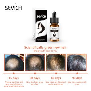 OEM private label hair care products hair regrowth oil