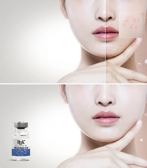 PDX4 Skin Booster Revitalizing