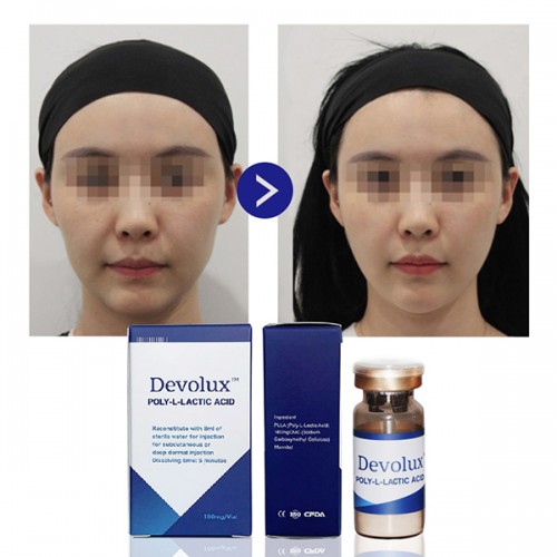 Devolux plla filler powder injection poly-l-lactic acid