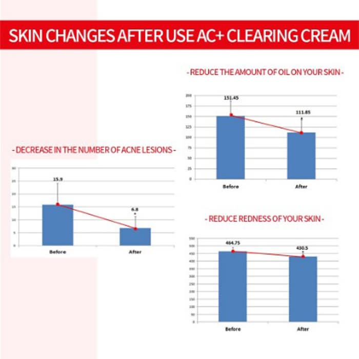Anti-Acne Cream