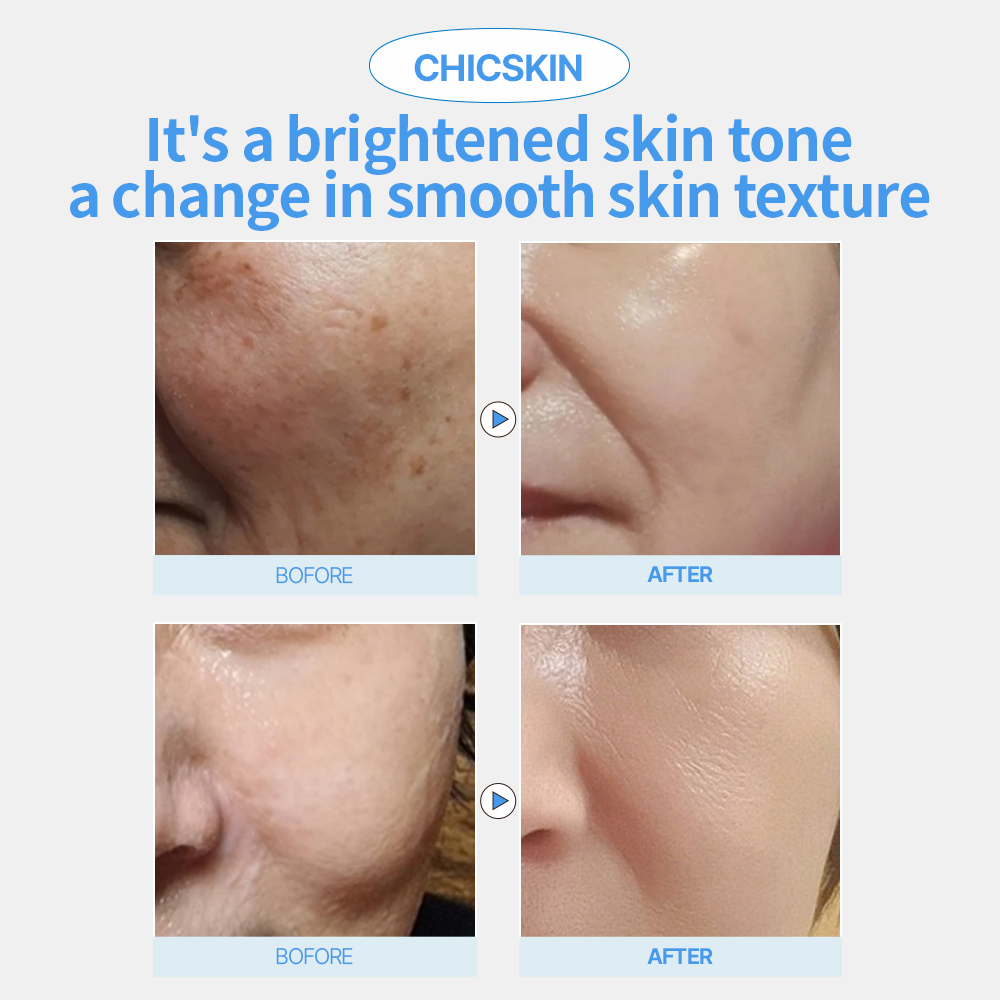 Facial Cleanser_CHICSKIN 6in1 Enzyme Wash Powder 80g