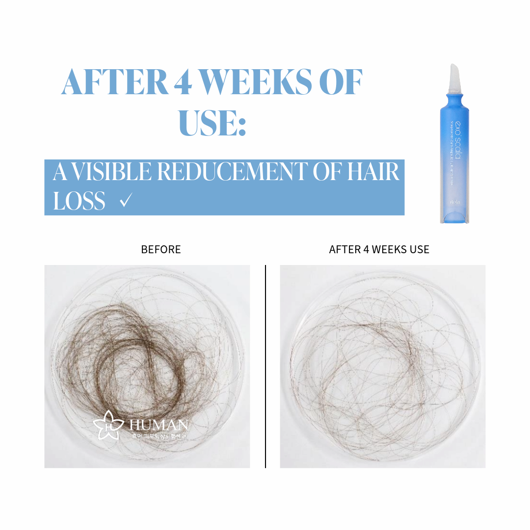 Riola Exo Scala Hair Loss Relief