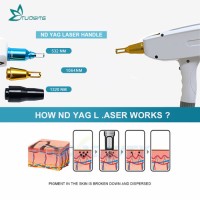 Professional 2 in 1 ND YAG Laser Tattoo Removal Diode Laser Hair Removal Machine