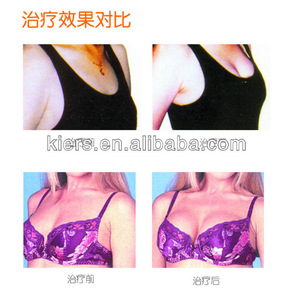 Breast Vibrating Care Enlarge Enhance Massage Vacuum Cup breast enlargement