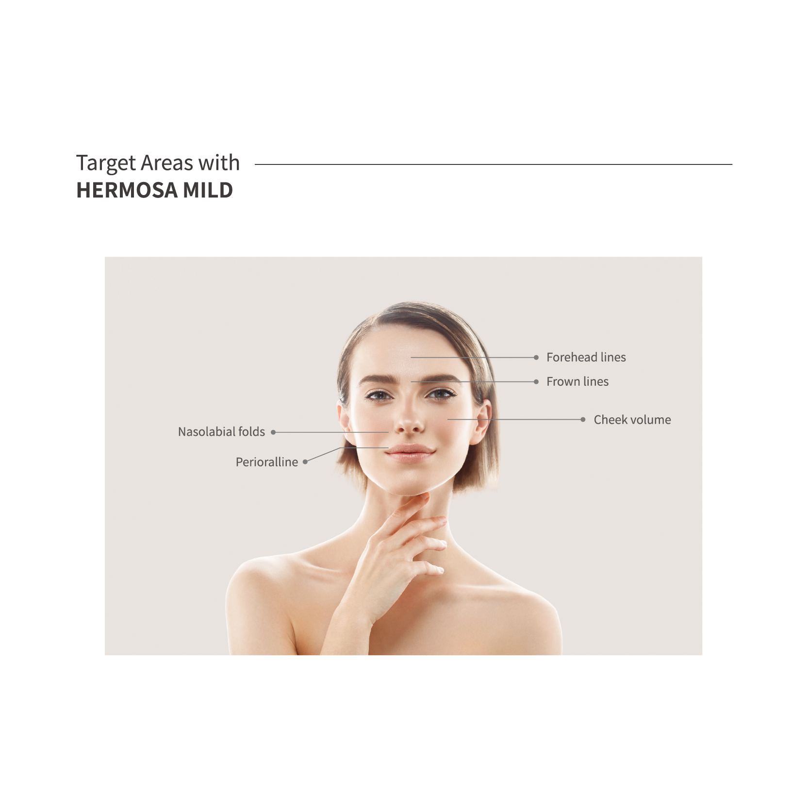 HERMOSA Dermal Filler_MILD