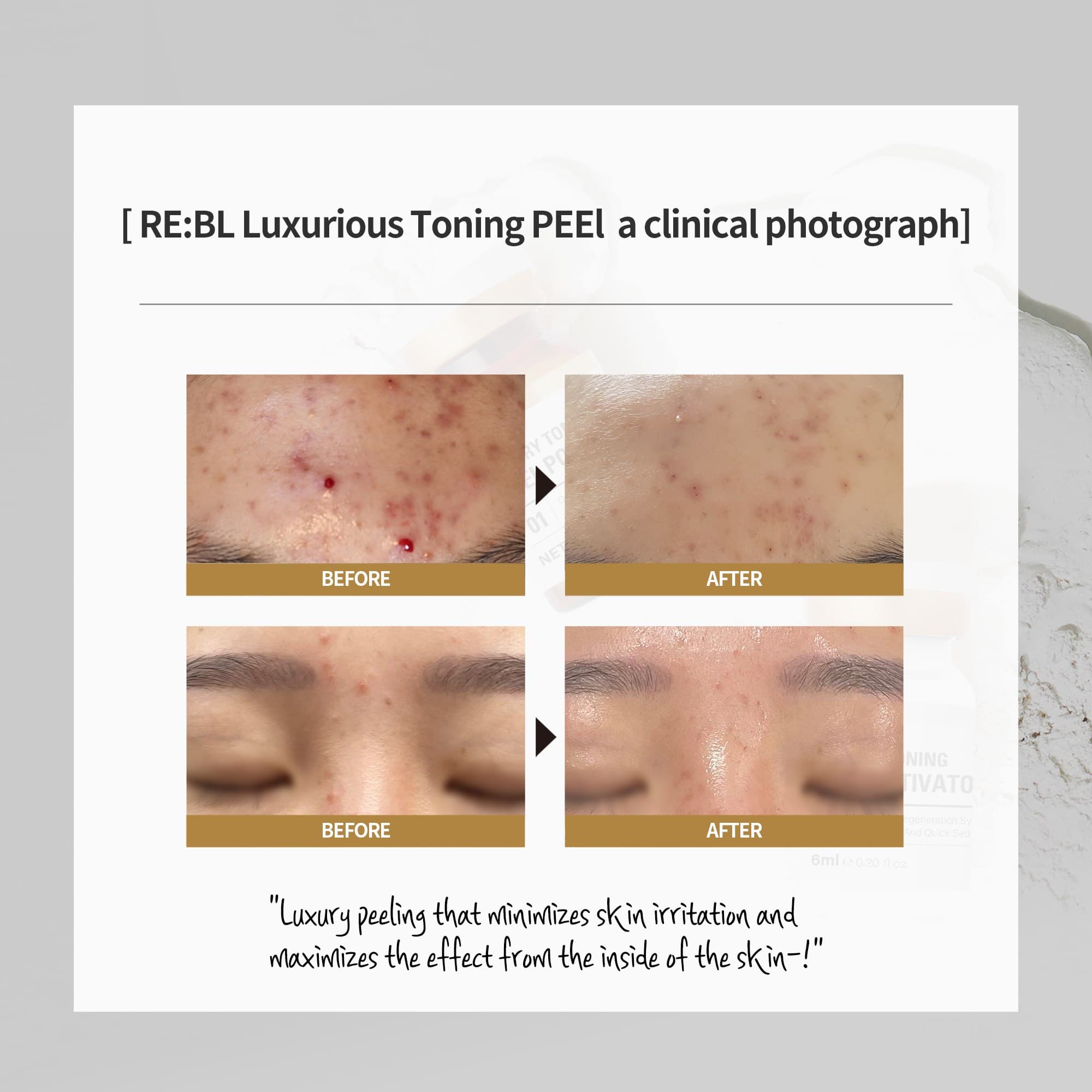 LUXURY TONING PEEL SET