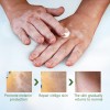 White Spot Ointment, Sweat Spot Pigmentation Patch, Skin Care Health Ointment