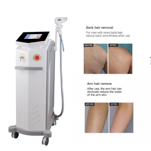 Medical CE TUV 808nm Diode Laser Hair Removal 808 Diode Laser Hair Removal Machine Prices