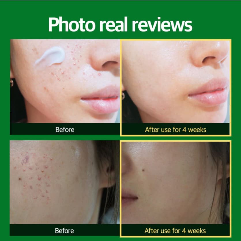 CICA Repair Cream