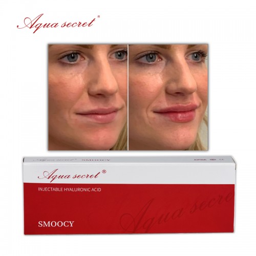 Aqua Secret hyaluronic injections acid lip filler injectable dermal filler