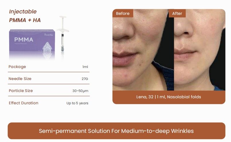 Injectable PMMA + HA