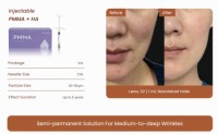 Injectable PMMA + HA