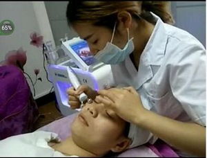 AYPLUS AYJ-X12F Deep Cleansing,Anti-Puffiness,Skin Tightening,Wrinkle Remover Feature and Anti-wrinkle Machine
