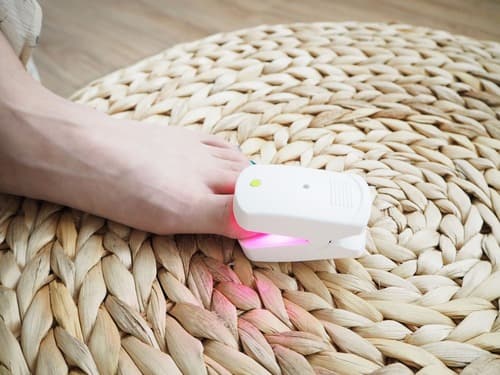 Nail Laser for Nail Fungus/Onychomycosis