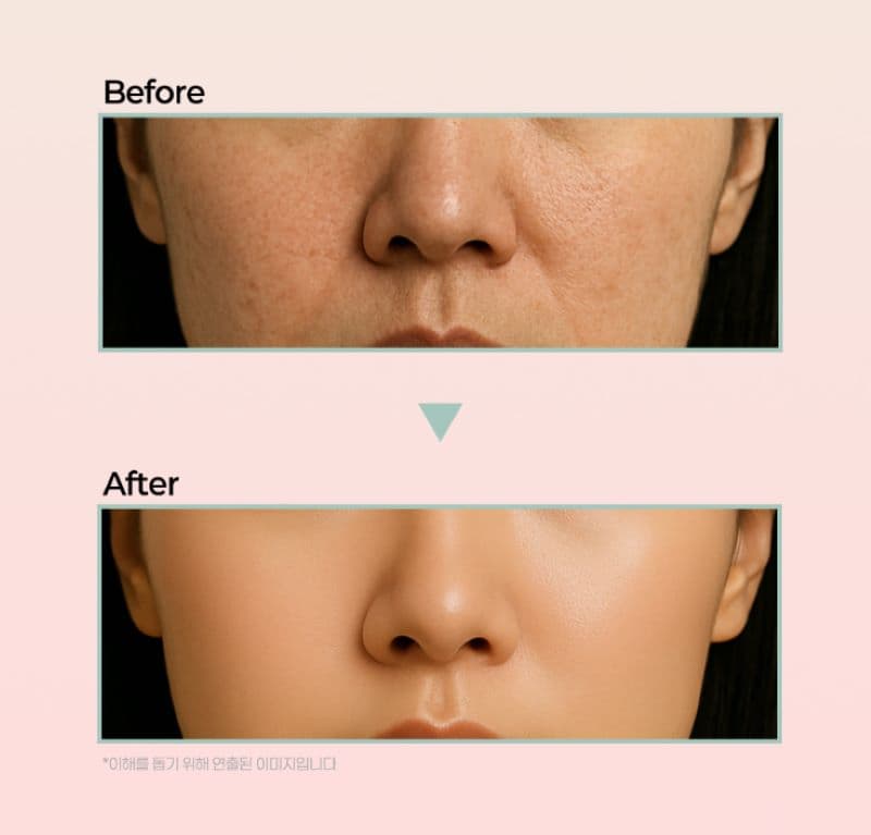 PDRN Elasticity Ampoule