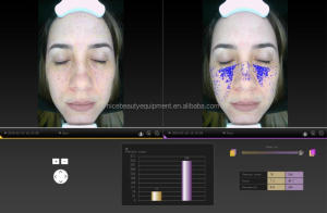 Skin Diagnostic Instrument Facial Magic Mirror Skin Analyzer