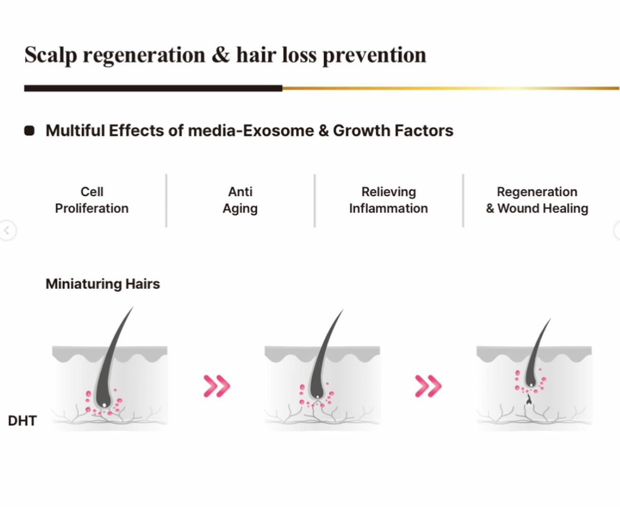 ULTRA HAIR  stem cell exosome-based hair loss treatment