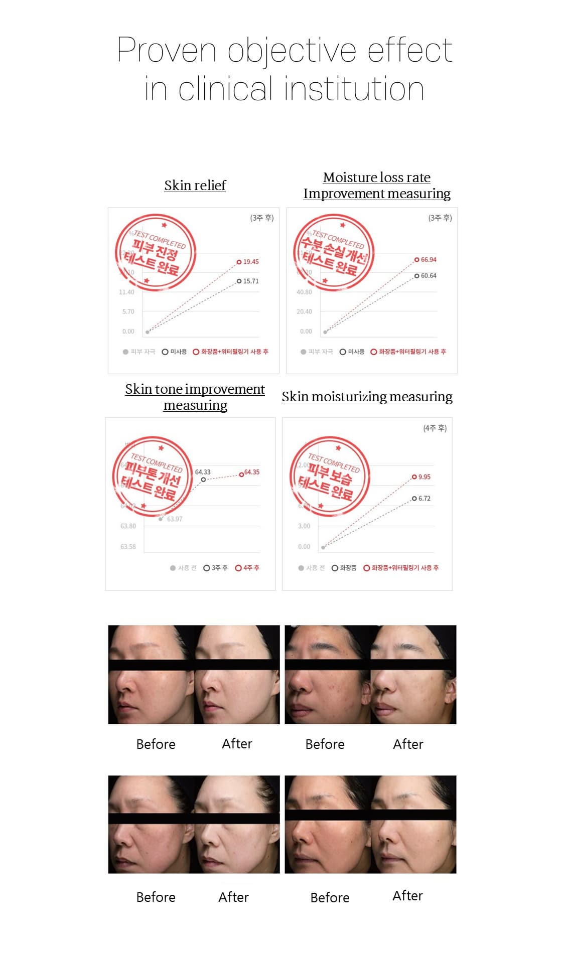 Water Peeling Device - Facial Skin Scrubber