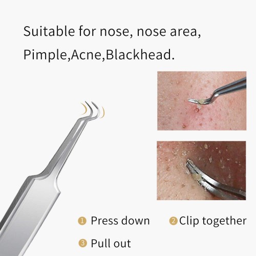 Professional Blackhead and Splinter Remover Tools Stainless Steel Easily Cure Pimples Whiteheads Comedones Acne Zit Ingrown