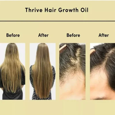 Wholesale Organic Fast Anti Hair Loss Treatment Regrowth Healthy Strong Biotin Hair Oil Hair Growth Serum