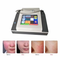 980nm Diode Laser Vascular Removal Machine for Doctors and Beauticians Use